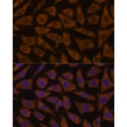 Immunofluorescence analysis of L929 cells using MTMR4 Antibody (1/100 dilution, 40x lens). Blue: DAPI for nuclear staining.