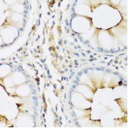 Immunohistochemistry of paraffin-embedded Human colon using RNASE3 Antibody (1/100 dilution, 40x lens).