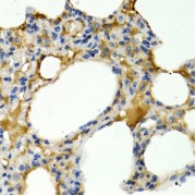 Immunohistochemistry of paraffin-embedded Rat lung using IL9 Antibody (1/200 dilution, 40x lens).