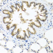 Immunohistochemistry of paraffin-embedded Rat lung using S100A7 Antibody (1/100 dilution, 40x lens).