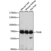 Western blot analysis of extracts of various cell lines using TNXB Antibody (1/1000 dilution).