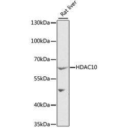 Histone Deacetylase 10 (HDAC10) Antibody