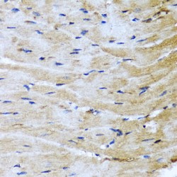 Cation Dependent Mannose 6-Phosphate Receptor (M6PR) Antibody