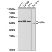 Western blot analysis of extracts of various cell lines using LIPA Antibody (1/1000 dilution).