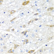 Immunohistochemistry of paraffin-embedded Rat brain using CPA6 Antibody (1/100 dilution, 40x lens).