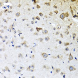 Carboxypeptidase A6 (CPA6) Antibody