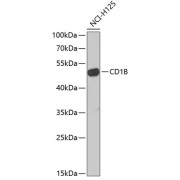 Western blot analysis of extracts of NCI-H125 cells using CD1B Antibody (1/1000 dilution).