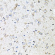 Immunohistochemistry of paraffin-embedded Mouse brain using KLK11 Antibody (1/100 dilution, 40x lens).