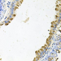 Kallikrein 11 (KLK11) Antibody