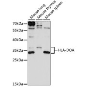 Western blot analysis of extracts of various cell lines using HLA-DOA Antibody (1/1000 dilution).