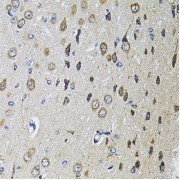 Immunohistochemistry of paraffin-embedded Rat brain using PTPRE Antibody (1/100 dilution, 40x lens).