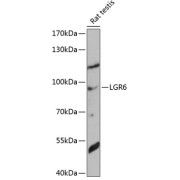 Western blot analysis of extracts of rat testis using LGR6 Antibody (1/1000 dilution).