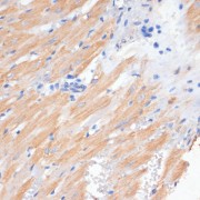 Immunohistochemistry of paraffin-embedded Rat heart using PDCD2L Antibody (1/100 dilution, 40x lens).