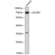 Western blot analysis of extracts of HepG2 cells using CACNB1 Antibody (1/1000 dilution).