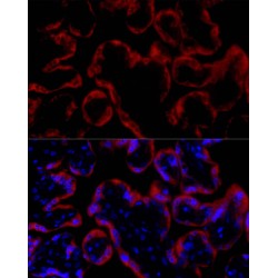 Somatotropin / Growth Hormone (GH1) Antibody