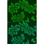 Immunofluorescence analysis of U2OS cells using HAUS8 Antibody (1/100 dilution). Blue: DAPI for nuclear staining.