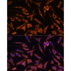 Acetyl Coenzyme A Acetyltransferase 2 (ACAT2) Antibody