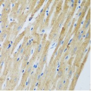 Immunohistochemistry of paraffin-embedded Rat heart using ADAM12 Antibody (1/100 dilution, 40x lens).