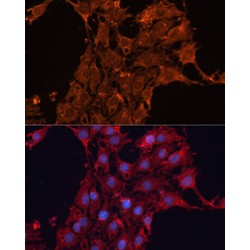 ADAM Metallopeptidase Domain 12 (ADAM12) Antibody