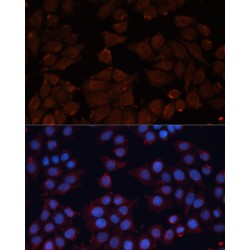 ADAM Metallopeptidase Domain 12 (ADAM12) Antibody