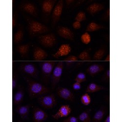 Polycomb Group RING Finger Protein 1 (PCGF1) Antibody