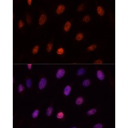 Polycomb Group RING Finger Protein 1 (PCGF1) Antibody