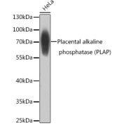 Western blot analysis of extracts of HeLa cells using Placental alkaline phosphatase Antibody (1/1000 dilution).