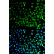 Immunofluorescence analysis of A549 cells using LHX6 Antibody