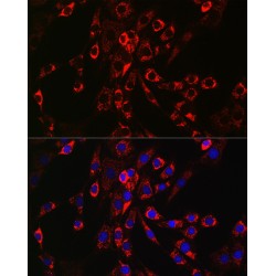 Proheparin-Binding EGF-Like Growth Factor (HBEGF) Antibody