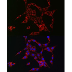 Proheparin-Binding EGF-Like Growth Factor (HBEGF) Antibody