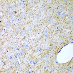 Inhibin Alpha (INHA) Antibody