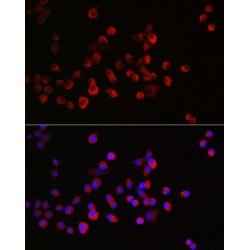 Collapsin Response Mediator Protein 1 (CRMP1) Antibody