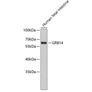 Western blot analysis of extracts of Human fetal intestine using GRB14 Antibody.