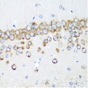 Immunohistochemistry of paraffin-embedded Rat brain using MTDH Antibody (1/200 dilution, 40x lens).