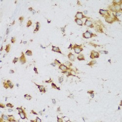 Metadherin (MTDH) Antibody