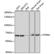 Western blot analysis of extracts of various cell lines using PTPRN Antibody (1/1000 dilution).