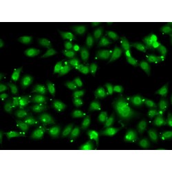 Nuclear Receptor Subfamily 2 Group C Member 1 (NR2C1) Antibody