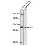 Western blot analysis of extracts of various cell lines using STC1 Antibody (1/1000 dilution).