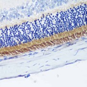 Immunohistochemistry of paraffin-embedded Rat retina using PDE6B Antibody (1/200 dilution, 40x lens).