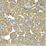 Immunohistochemistry of paraffin-embedded Rat kidney using PSMD5 Antibody (1/100 dilution, 40x lens).