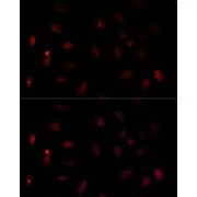 Immunofluorescence analysis of U-2 OS cells using PAX6 Antibody (1/100 dilution). Blue: DAPI for nuclear staining.