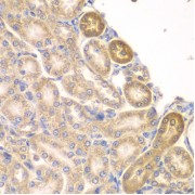 Immunohistochemistry of paraffin-embedded Rat kidney using PIP4K2A Antibody (1/100 dilution, 40x lens).