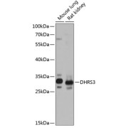 Western blot analysis of extracts of various cell lines using DHRS3 Antibody (1/1000 dilution).