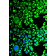 Immunofluorescence analysis of A549 cells using TBPL1 Antibody