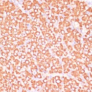 Immunohistochemistry of paraffin-embedded Rat ovary using MAP2K3 Antibody (1/100 dilution, 40x lens).