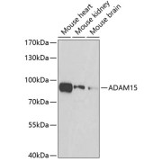 Western blot analysis of extracts of various cell lines using ADAM15 Antibody (1/50 dilution)0.