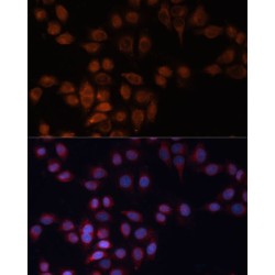 A Disintegrin And Metalloprotease 15 (ADAM15) Antibody