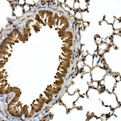 Sequestosome 1 (SQSTM1) Antibody
