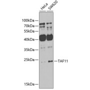 Western blot analysis of extracts of various cell lines using TAF11 Antibody (1/1000 dilution).