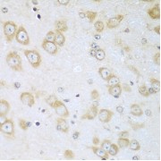 Immunohistochemistry of paraffin-embedded Mouse brain using ACOX1 Antibody (1/100 dilution, 40x lens).